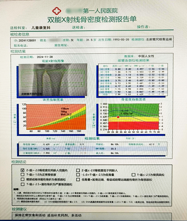 雙能X射線骨密度儀檢測(cè)報(bào)告中的T值與Z值的深度解讀